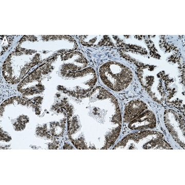 Anti-dsDNA Antibody, clone AE-2 ZooMAb® Mouse Monoclonal，4X25UL，ZMS1047-4X25UL，Sigma