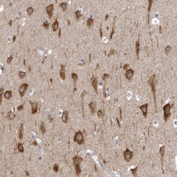 Anti-NCEH1 antibody produced in rabbit，100UL，HPA026888-100UL，Sigma