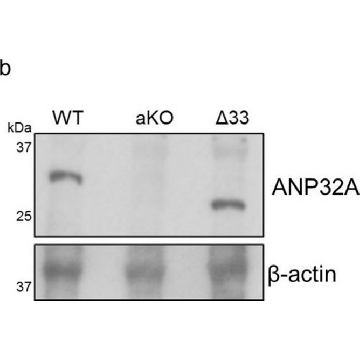Anti-ANP32A (AB1) antibody produced in rabbit，100UL，AV40203-100UL，Sigma