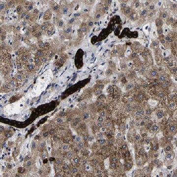 Anti-SCD antibody produced in rabbit，100UL，HPA012107-100UL，Sigma