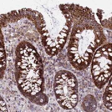 Anti-C16orf54 antibody produced in rabbit，100UL，HPA060546-100UL，Sigma