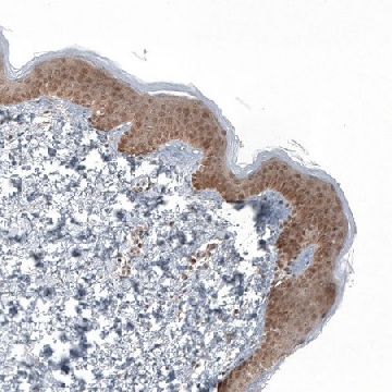 Anti-KLHL24 antibody produced in rabbit，100UL，HPA056337-100UL，Sigma