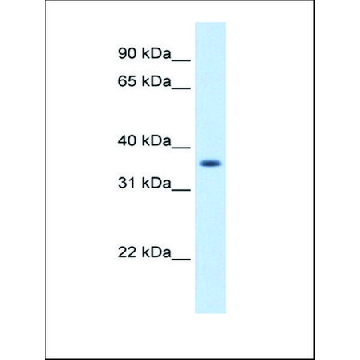 Anti-AKR1B10 antibody produced in rabbit，100UL，AV42553-100UL，Sigma