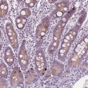 Anti-PRAP1 antibody produced in rabbit，100UL，HPA038713-100UL，Sigma