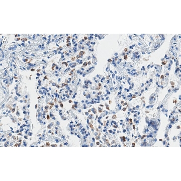 Anti-SFTPC Antibody, clone 3F18 ZooMAb® Rabbit Monoclonal，25UL，ZRB1496-25UL，Sigma