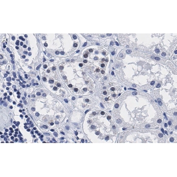 Anti-PARP-1 Antibody, clone 12N17 Antibody, ZooMAb® Rabbit Monoclonal，25UL，ZRB1545-25UL，Sigma
