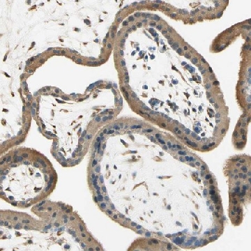 Anti-IGDCC4 antibody produced in rabbit，100UL，HPA008576-100UL，Sigma
