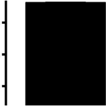 Anti-ODF2 antibody produced in rabbit，100UL，HPA001874-100UL，Sigma