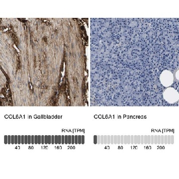 Anti-COL6A1 antibody produced in rabbit，100UL，HPA019142-100UL，Sigma