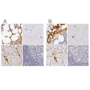 Anti-AHSG antibody produced in rabbit，100UL，HPA001524-100UL，Sigma