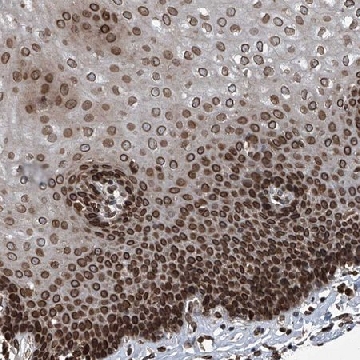 Anti-PHF20 antibody produced in rabbit，100UL，HPA029621-100UL，Sigma