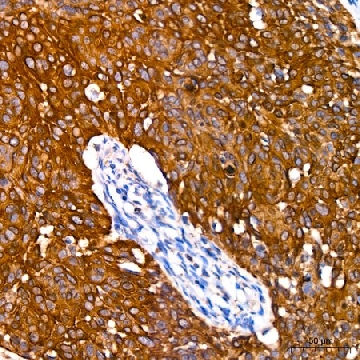 Anti-Cytokeratin 14 (KRT14) Antibody, clone 5Z4O9, Rabbit Monoclonal，100UL，SAB5702924-100UL，Sigma