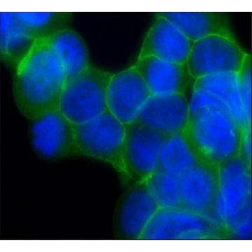 Anti-β-Catenin antibody, Mouse monoclonal，100UL，SAB4200720-100UL，Sigma