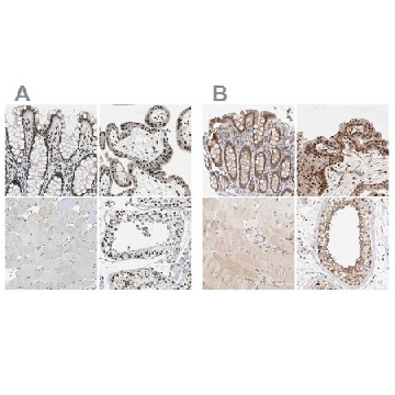 Anti-GATAD2A antibody produced in rabbit，100UL，HPA006759-100UL，Sigma