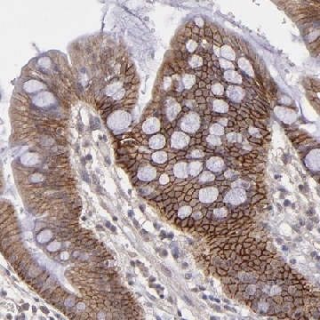ANTI-FAT1 antibody produced in rabbit，100UL，HPA001869-100UL，Sigma
