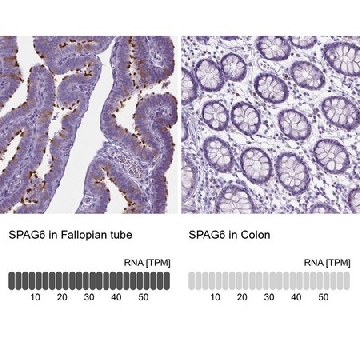 抗-SPAG6 兔抗，100UL，HPA038440-100UL，Sigma