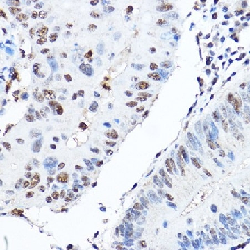 Anti- CTCF antibody produced in rabbit，100UL，SAB5701132-100UL，Sigma