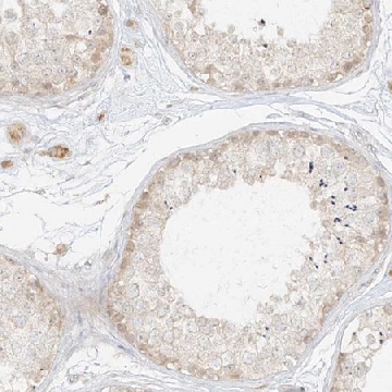 Anti-LIPT1 antibody produced in rabbit，100UL，HPA034802-100UL，Sigma
