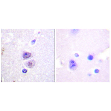 Anti-p38 MAPK antibody produced in rabbit，100UG，SAB4500490-100UG，Sigma