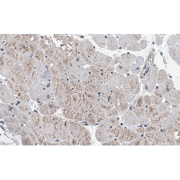 Anti-RHOT1/MIRO-1 Antibody, clone 1F4 ZooMAb® Rabbit Monoclonal，25UL，ZRB1674-25UL，Sigma