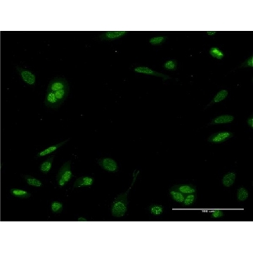 Monoclonal Anti-NEUROD6 antibody produced in mouse，100UG，WH0063974M6-100UG，Sigma