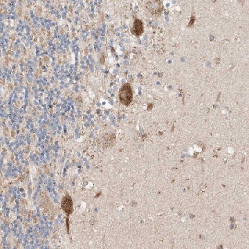 Anti-MOSPD1 antibody produced in rabbit，100UL，HPA031158-100UL，Sigma