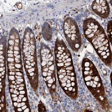 Anti-IL17RD antibody produced in rabbit，100UL，HPA039577-100UL，Sigma