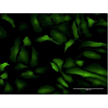 Monoclonal Anti-S100A10 antibody produced in mouse，100UG，SAB1404349-100UG，Sigma