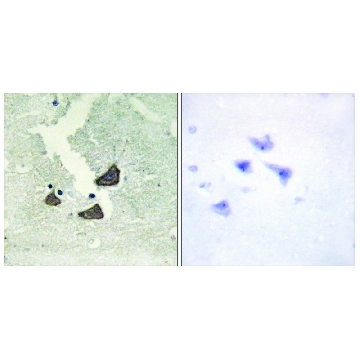 Anti-EPHB6 antibody produced in rabbit，100UG，SAB4503476-100UG，Sigma