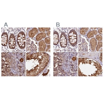 Anti-ST13 antibody produced in rabbit，100UL，HPA043233-100UL，Sigma