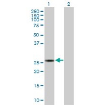 Anti-SPR antibody produced in rabbit，100UG，SAB1411312-100UG，Sigma