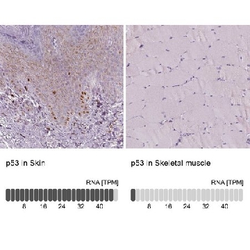 单克隆抗  p53 小鼠抗，100UL，AMAB90956-100UL，Sigma