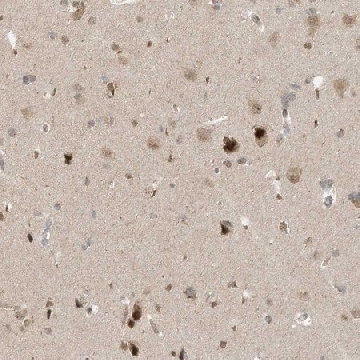 Anti-MXI1 antibody produced in rabbit，100UL，HPA035319-100UL，Sigma
