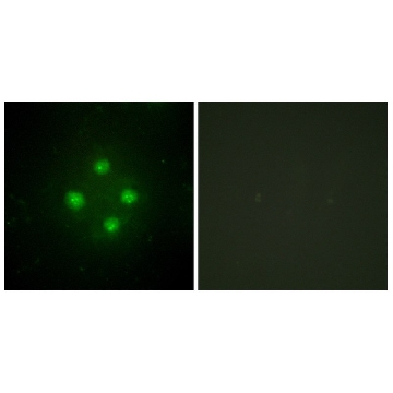Anti-MED24 antibody produced in rabbit，100UG，SAB4503717-100UG，Sigma
