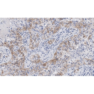 Anti-Integrin αVβ3 Antibody, clone EM22703 ZooMAb® Rabbit Monoclonal，4X25UL，ZRB1190-4X25UL，Sigma