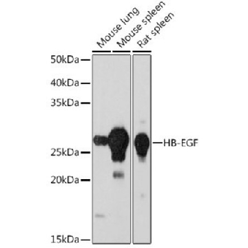 Anti- HB-EGF antibody produced in rabbit，100UL，SAB5701006-100UL，Sigma