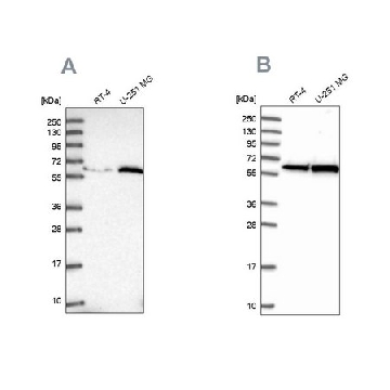 Anti-KPNA4 antibody produced in rabbit，100UL，HPA045500-100UL，Sigma