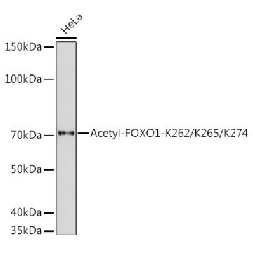 Anti-Acetyl-FOXO1-K262/K265/K274 antibody produced in rabbit，100UL，SAB5701098-100UL，Sigma