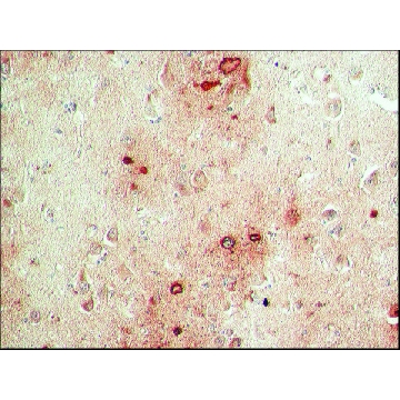Anti-Presenilin-1 (S182) antibody produced in rabbit，0.2ML，P7854-.2ML，Sigma