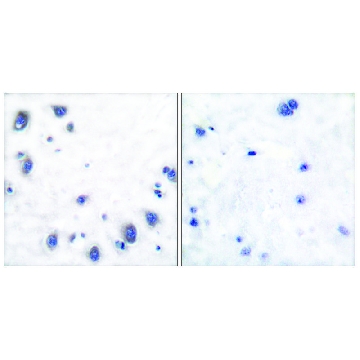 Anti-Tyrosine Hydroxylase, N-Terminal antibody produced in rabbit，100UG，SAB4502966-100UG，Sigma