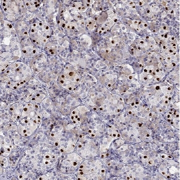 Anti-TBX19 antibody produced in rabbit，100UL，HPA072686-100UL，Sigma