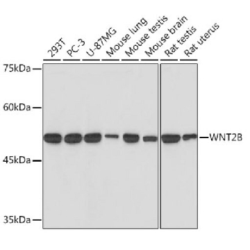 Anti-WNT2B Antibody, clone 9M6O7, Rabbit Monoclonal，100UL，SAB5702802-100UL，Sigma