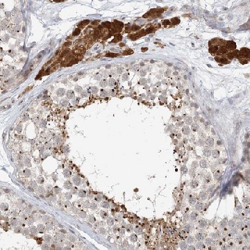 Anti-ZCCHC4 antibody produced in rabbit，100UL，HPA035575-100UL，Sigma