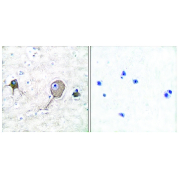Anti-NSE antibody produced in rabbit，100UG，SAB4500768-100UG，Sigma