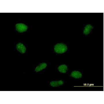 Anti-PHF19 antibody produced in mouse，50UG，SAB1400484-50UG，Sigma