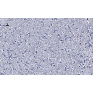 Anti-β-Tubulin III Antibody, clone 5H16, ZooMAb® Rabbit Monoclonal，4X25UL，ZRB1140-4X25UL，Sigma