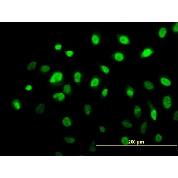 Monoclonal Anti-AHR antibody produced in mouse，100UG，WH0000196M2-100UG，Sigma