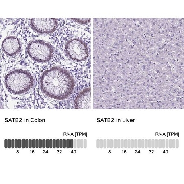 Anti-SATB2 antibody produced in rabbit，100UL，HPA029543-100UL，Sigma