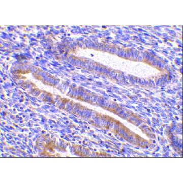 Anti-TIM-1 antibody produced in rabbit，100UG，SAB3500252-100UG，Sigma