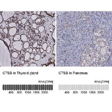 Anti-CTSB antibody produced in rabbit，100UL，HPA048998-100UL，Sigma